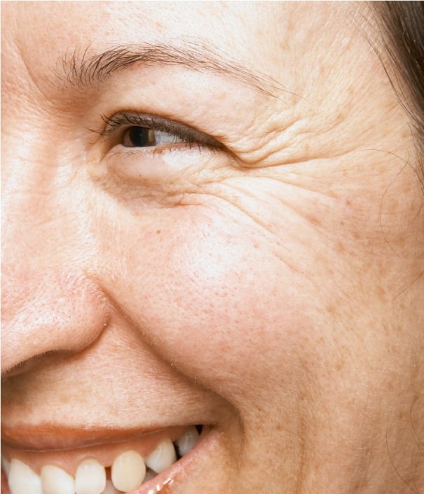 Crows Feet Before