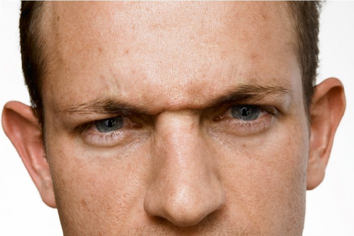 Male Frown line – Before